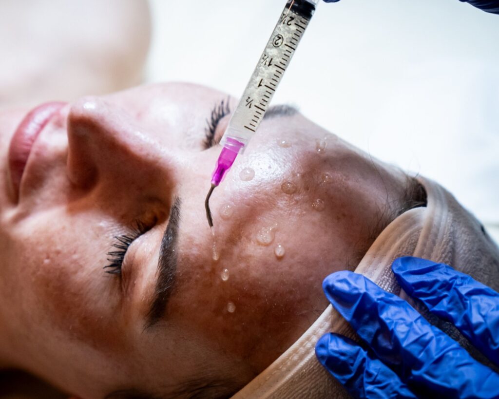 PRX Derm Perfexion in Estero, FL