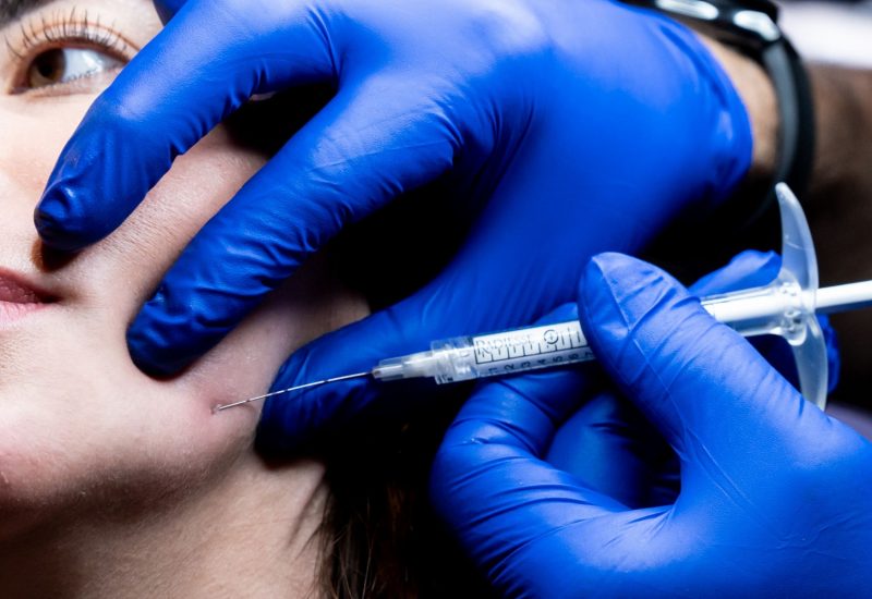 TLLS Estero Derma Filler