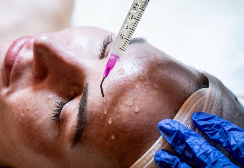 PRX Derm Perfexion in Estero, FL