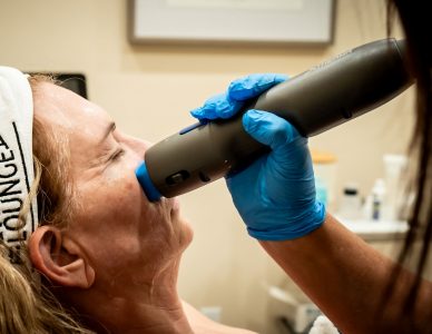 Provider using a handheld RF microneedling device on a client's cheek