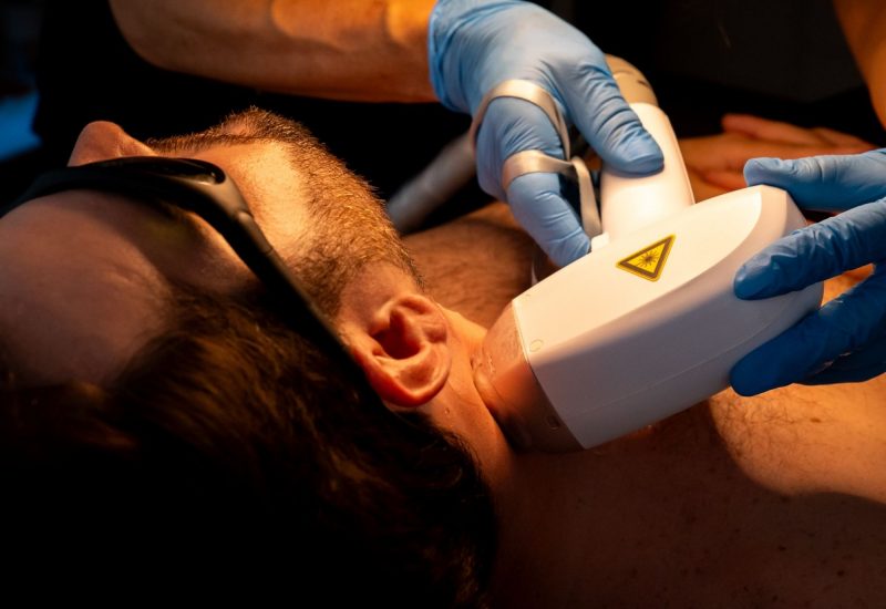 TLLS Estero Laser Treatment