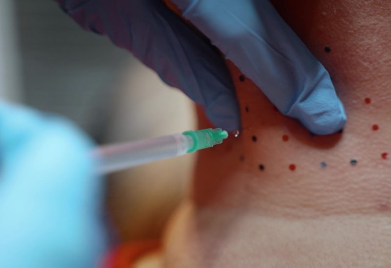 TLLS Estero PCDC Lipodissolve